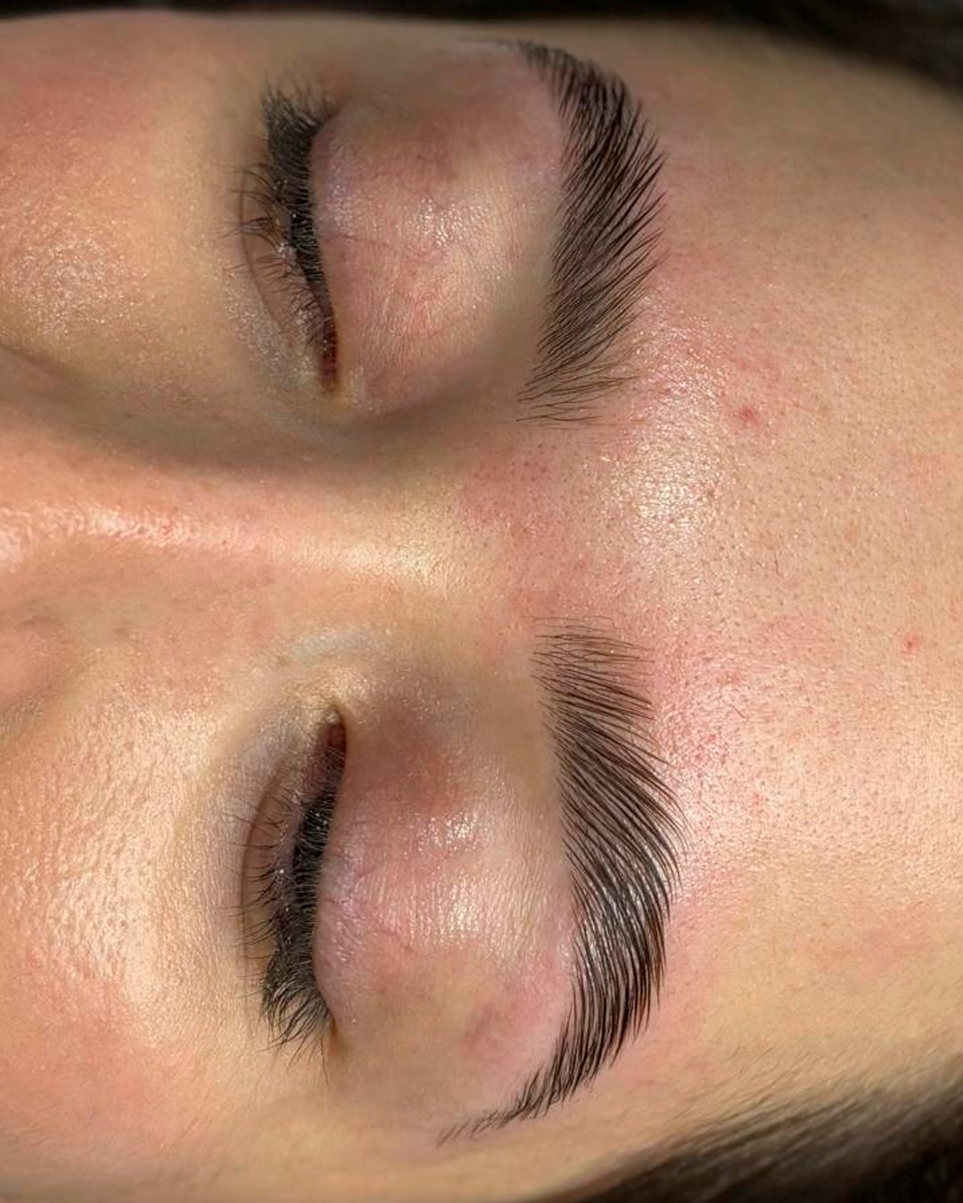 Resultado Studio Githa - Massagem Facial